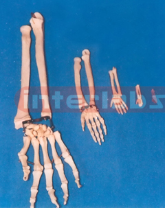 ADULT HAND BONE WITH RAPLUS AND ULNA